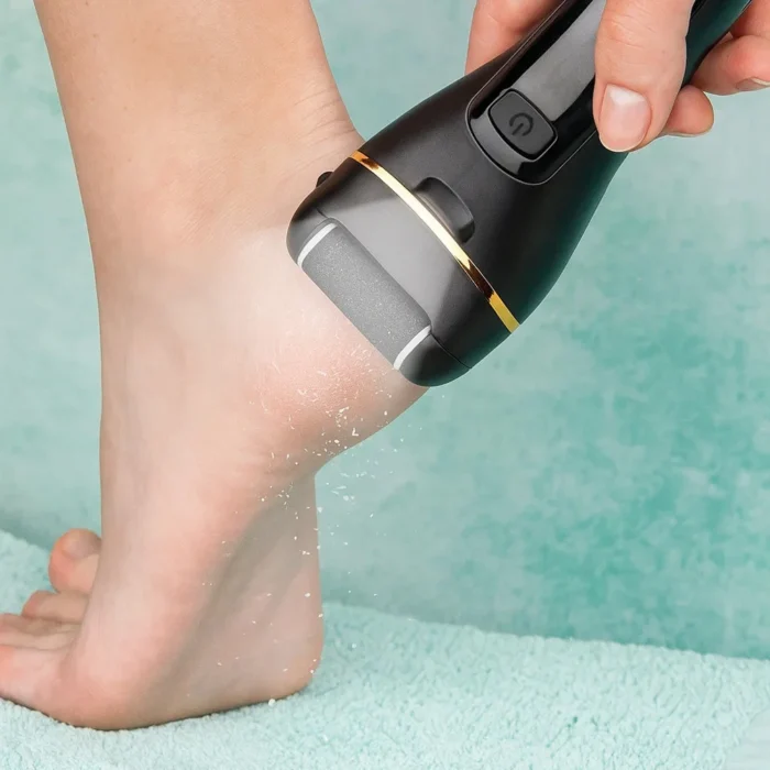 AlleLac Kit Pedicura V-601 - Imagen 1